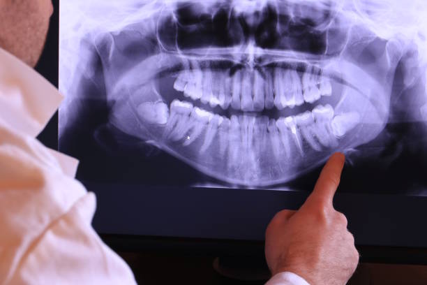 Best Emergency Treatment for Toothache in Oceano, CA